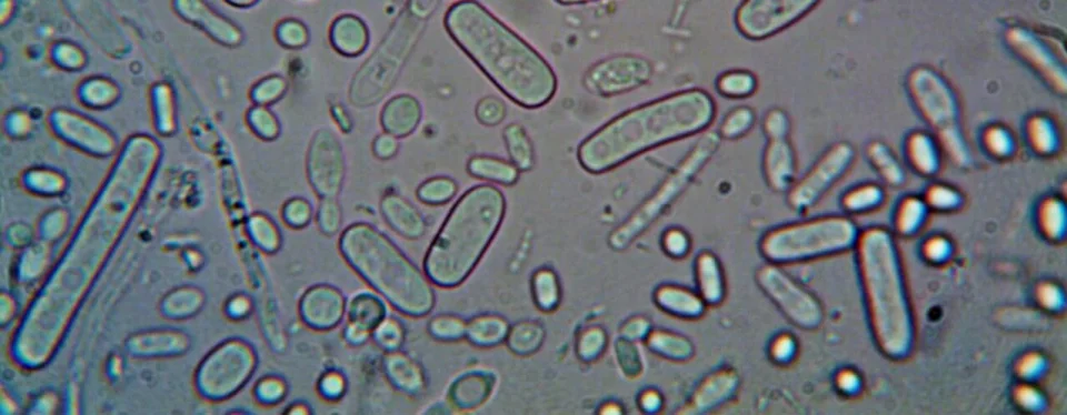 Legionella, nákazy a prevence - vše, co potřebujete vědět.