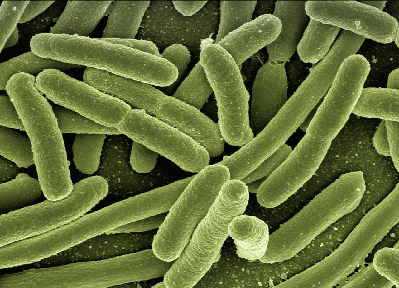 bakteria e-coli bakteria e-coli